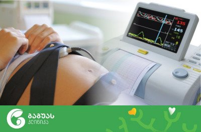კარდიოტოკოგრაფია