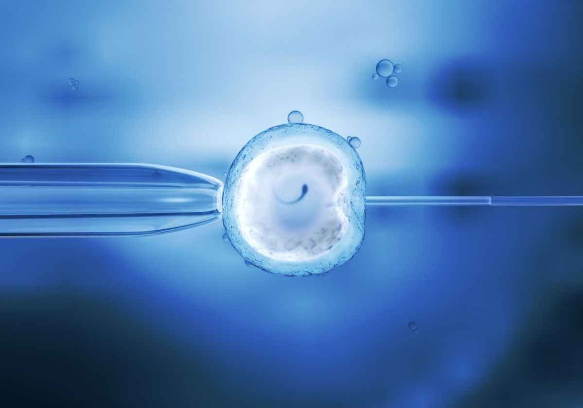 ინ ვიტრო განაყოფიერება (IVF/ICSI)