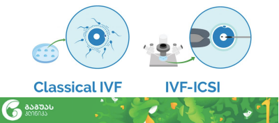 ინ ვიტრო განაყოფიერება IVF & ინტრაციტოპლაზმური სპერმის ინექცია ICSI