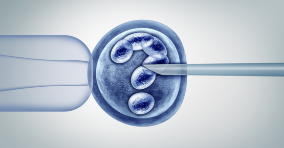 Intrauterine Insemination (IUI)
